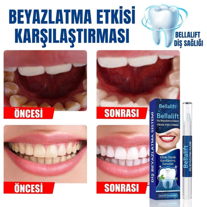 Diş Beyazlatma Kalemi